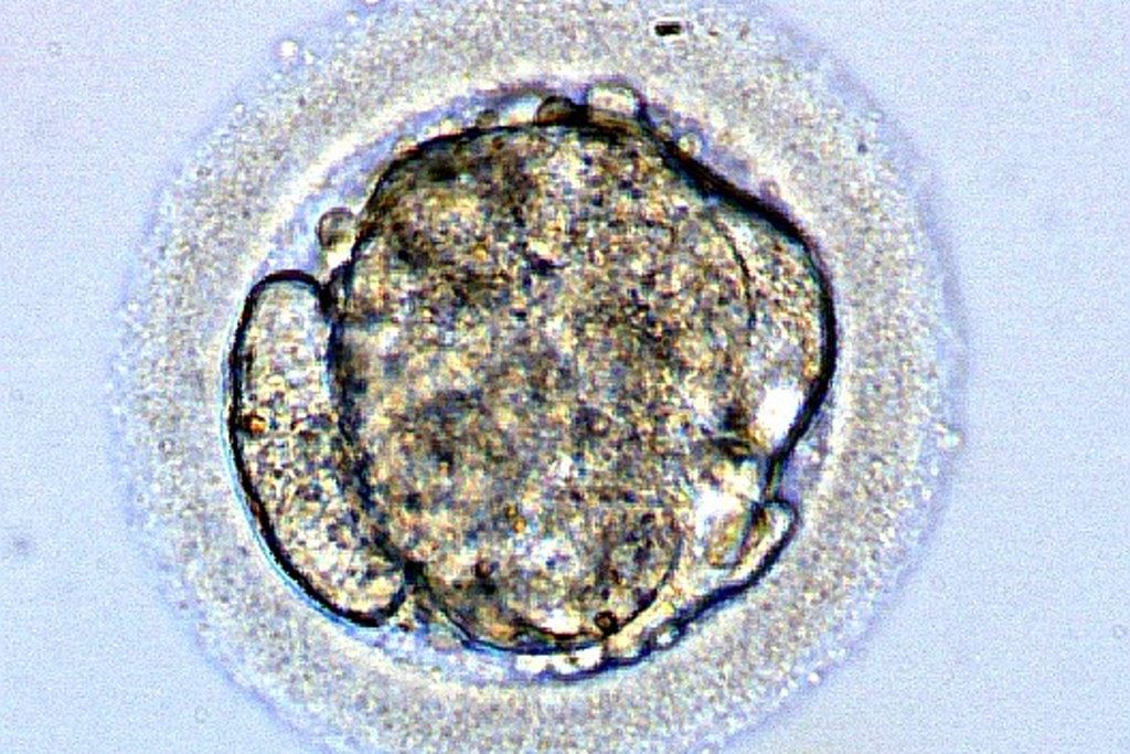 Embryo development and evaluation, part 1