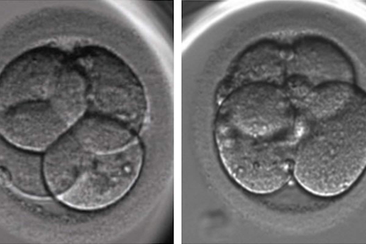 Embryo evaluation, part 2: Cleavage stage embryos